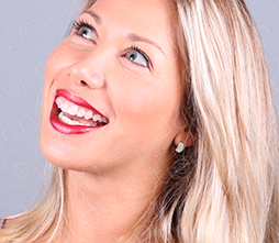 Veja o New Evolution em uso